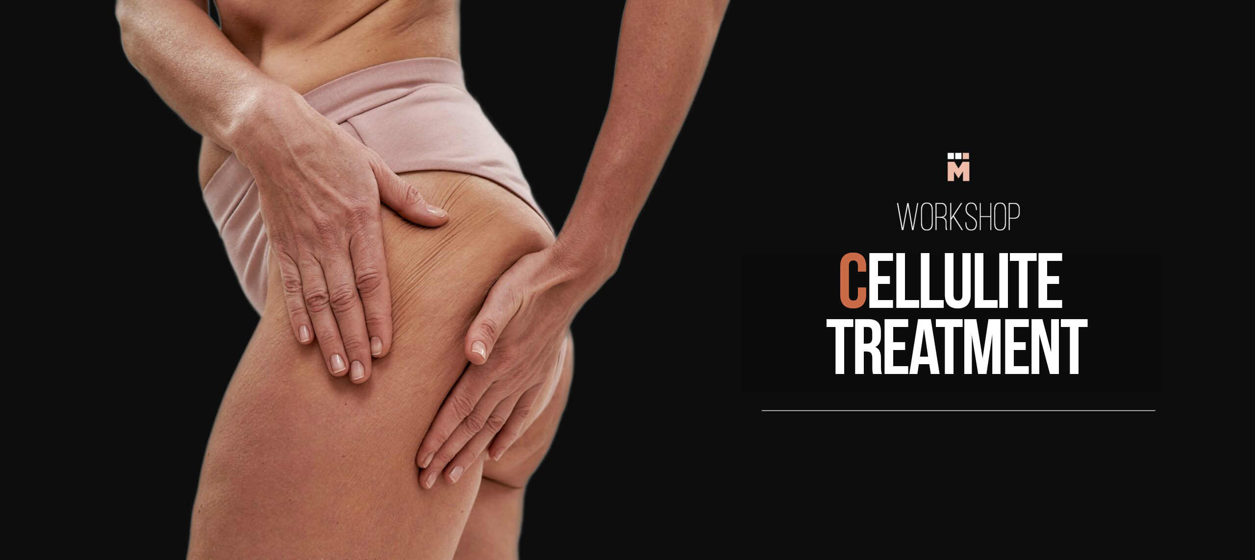 Medical-casting-agency-model-recruiting-workshop-cellulite-treatment