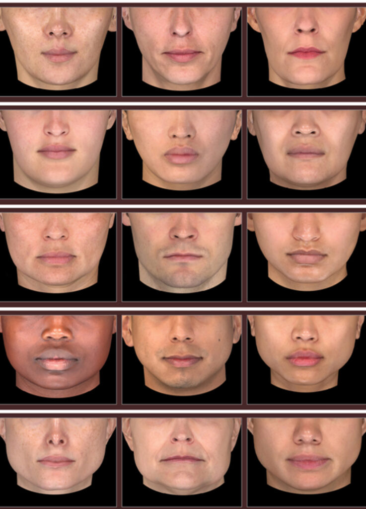 Aesthetic Model World Recruitment, AMWR, Abbvie, Karma Group